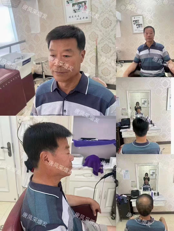 北京定制假发 \
