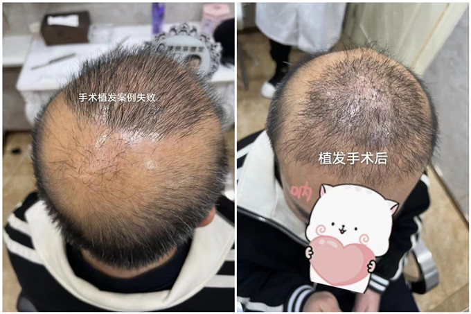 北京假发 \