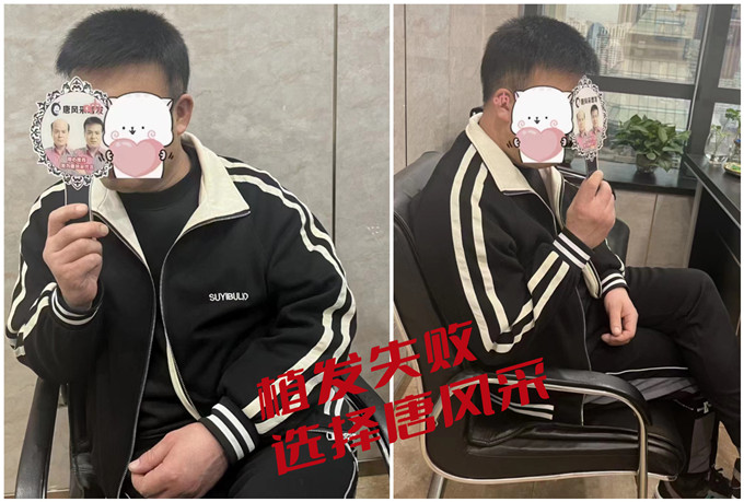 北京假发 \