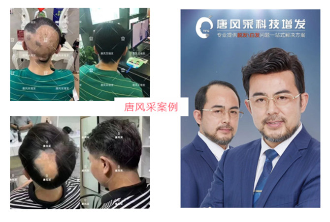 朝阳男士假发店 \