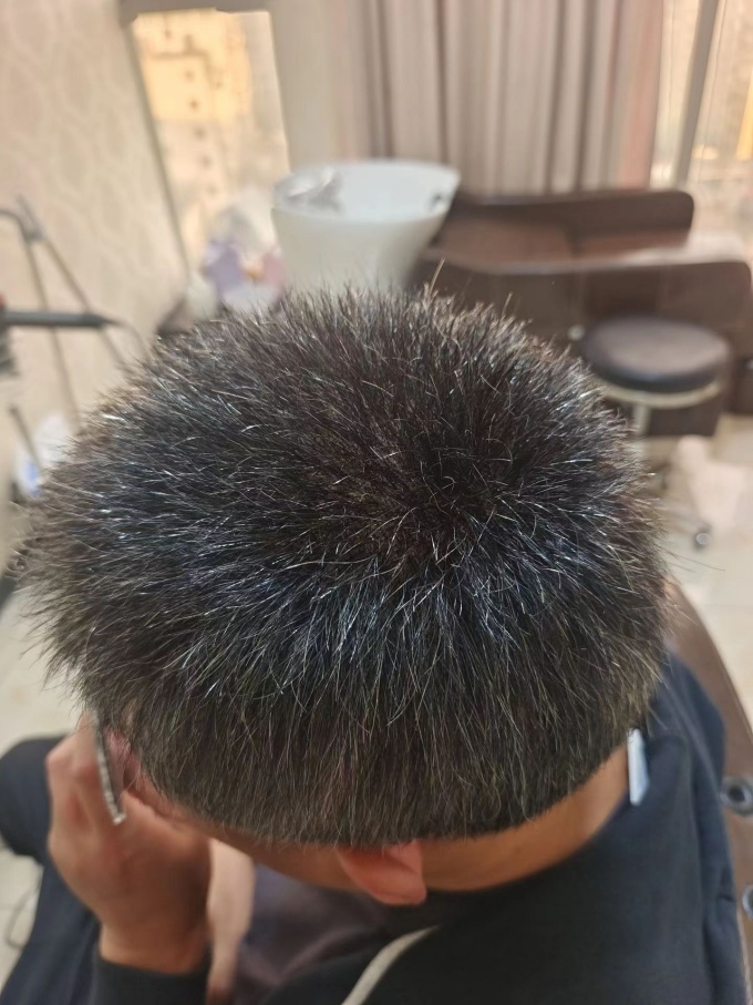 嘉兴假发定制店 \