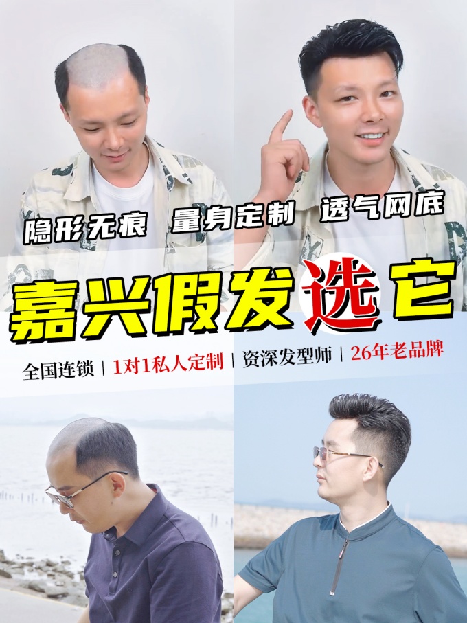 嘉兴假发定制店 \