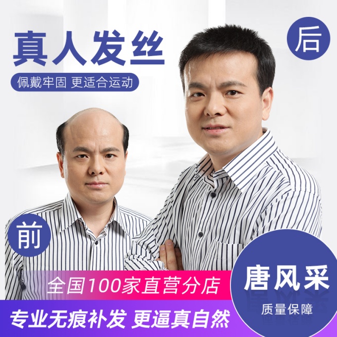 嘉兴假发定制店 \