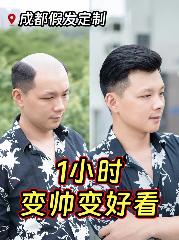 成都假发哪家好 \