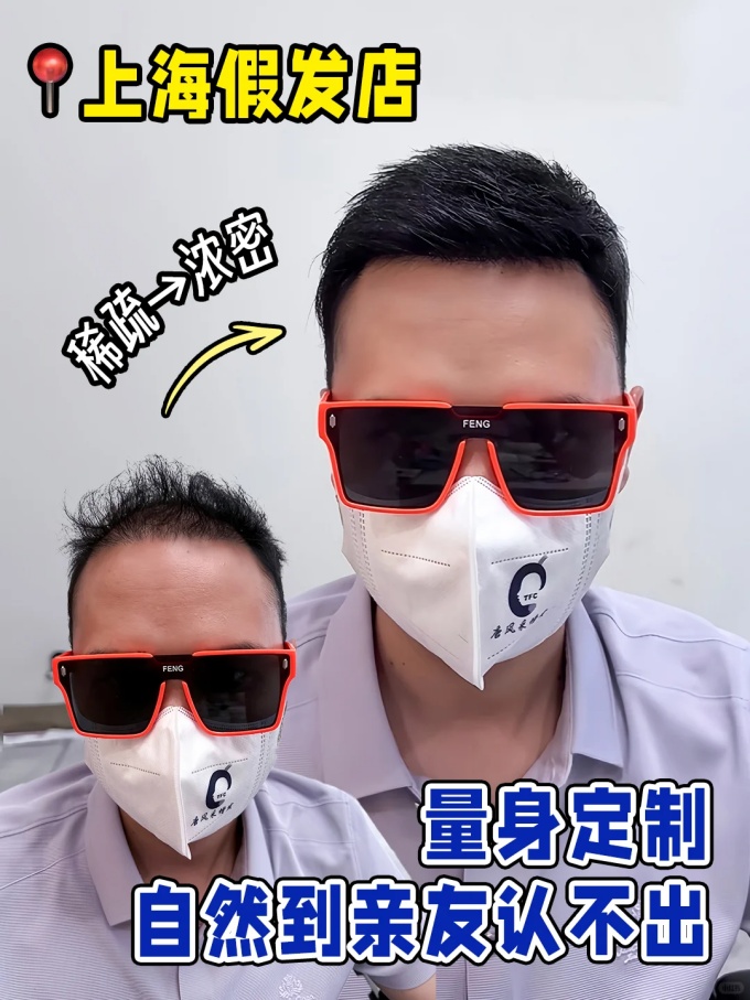 上海假发定制 \