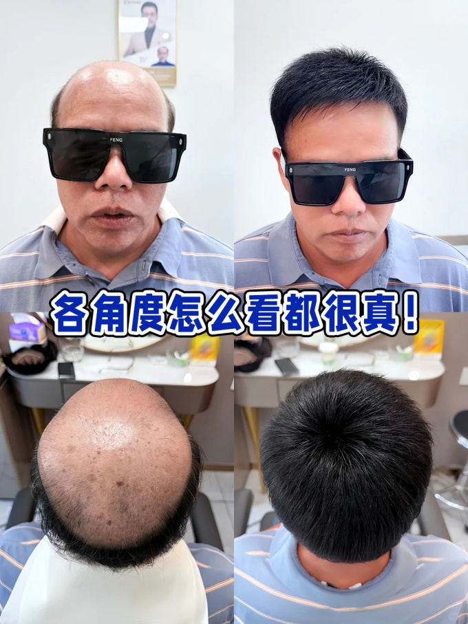 上海假发定制 \
