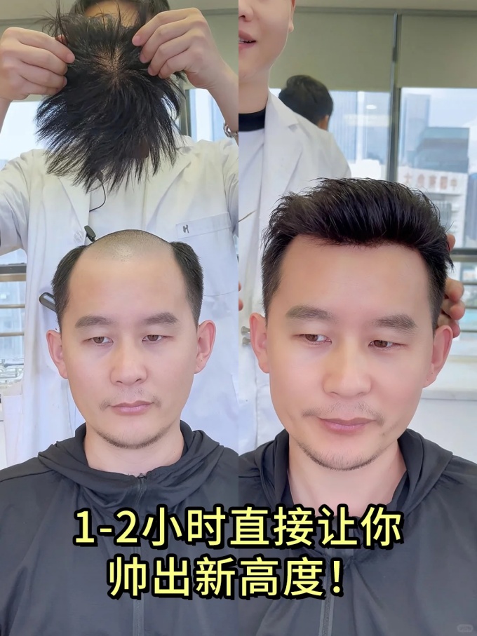 武汉假发 \