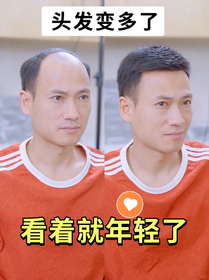 济南定制假发 \