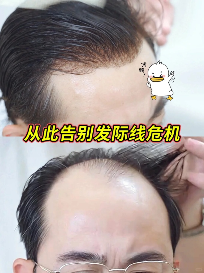 深圳定制假发,假发行业 \