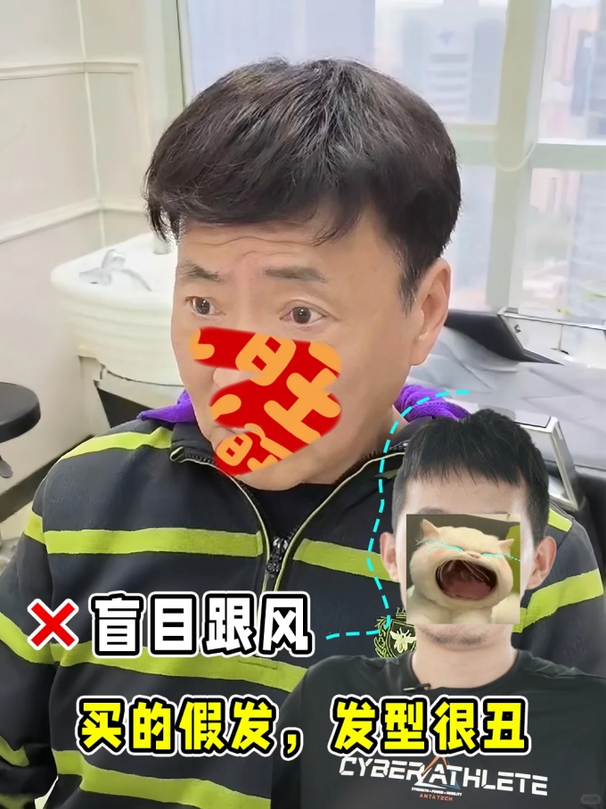 谢顶男人变帅、北京假发 \