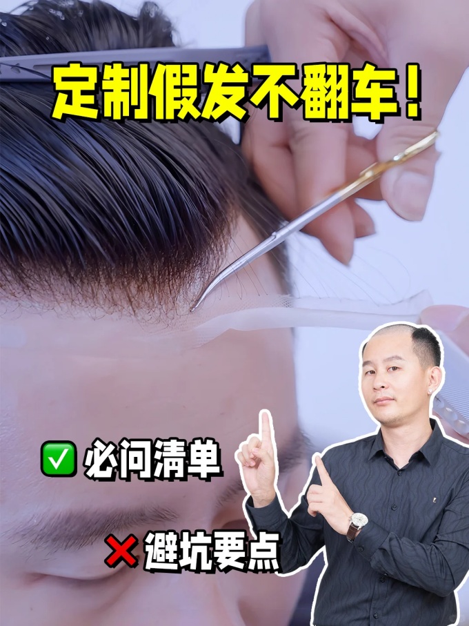 男士定制假发避雷指南 \