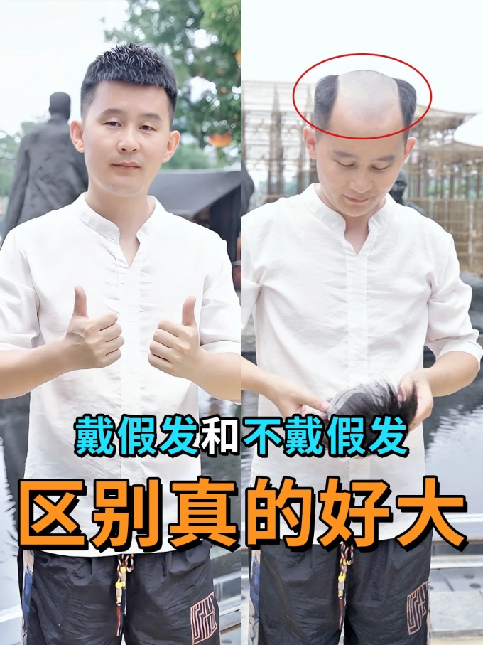 银川定制假发 \