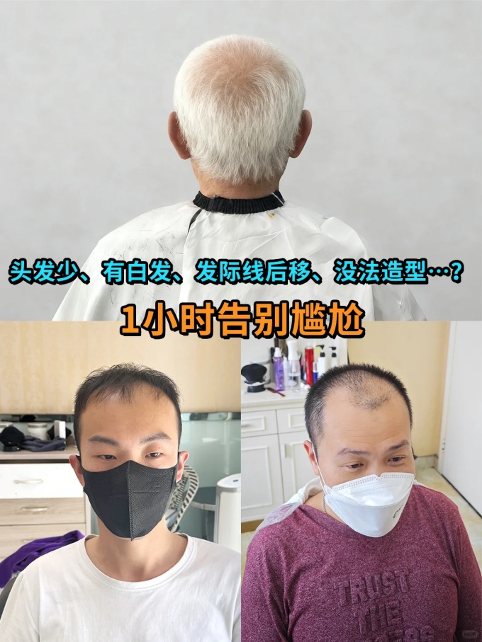 银川定制假发 \