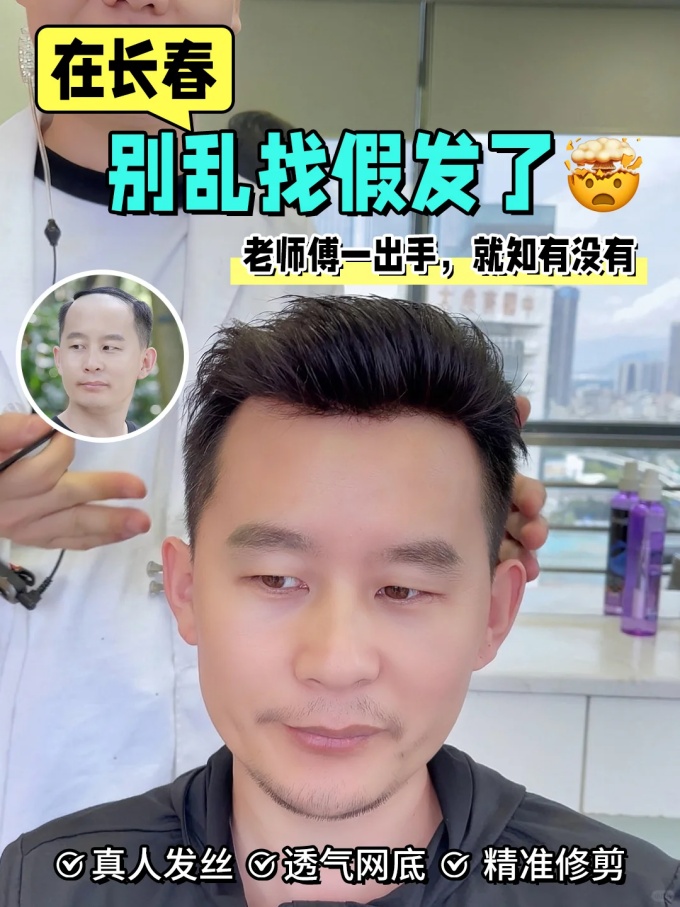 长春假发,发量救星 \