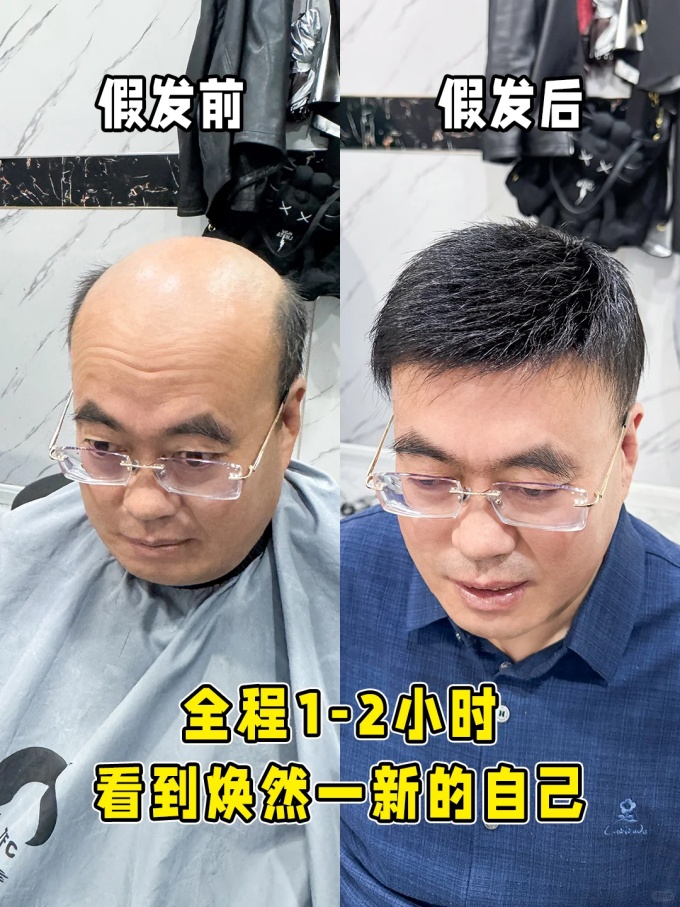 西宁假发定制 \