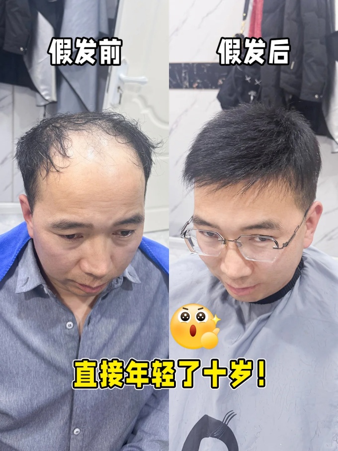 西宁假发定制 \