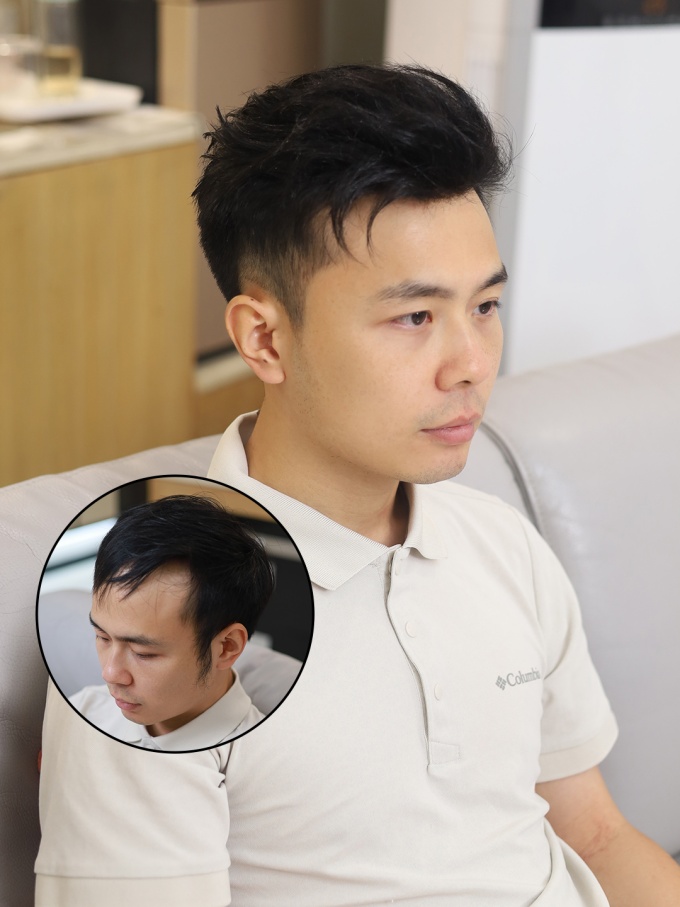 发量扁塌,,假发真的有用 \