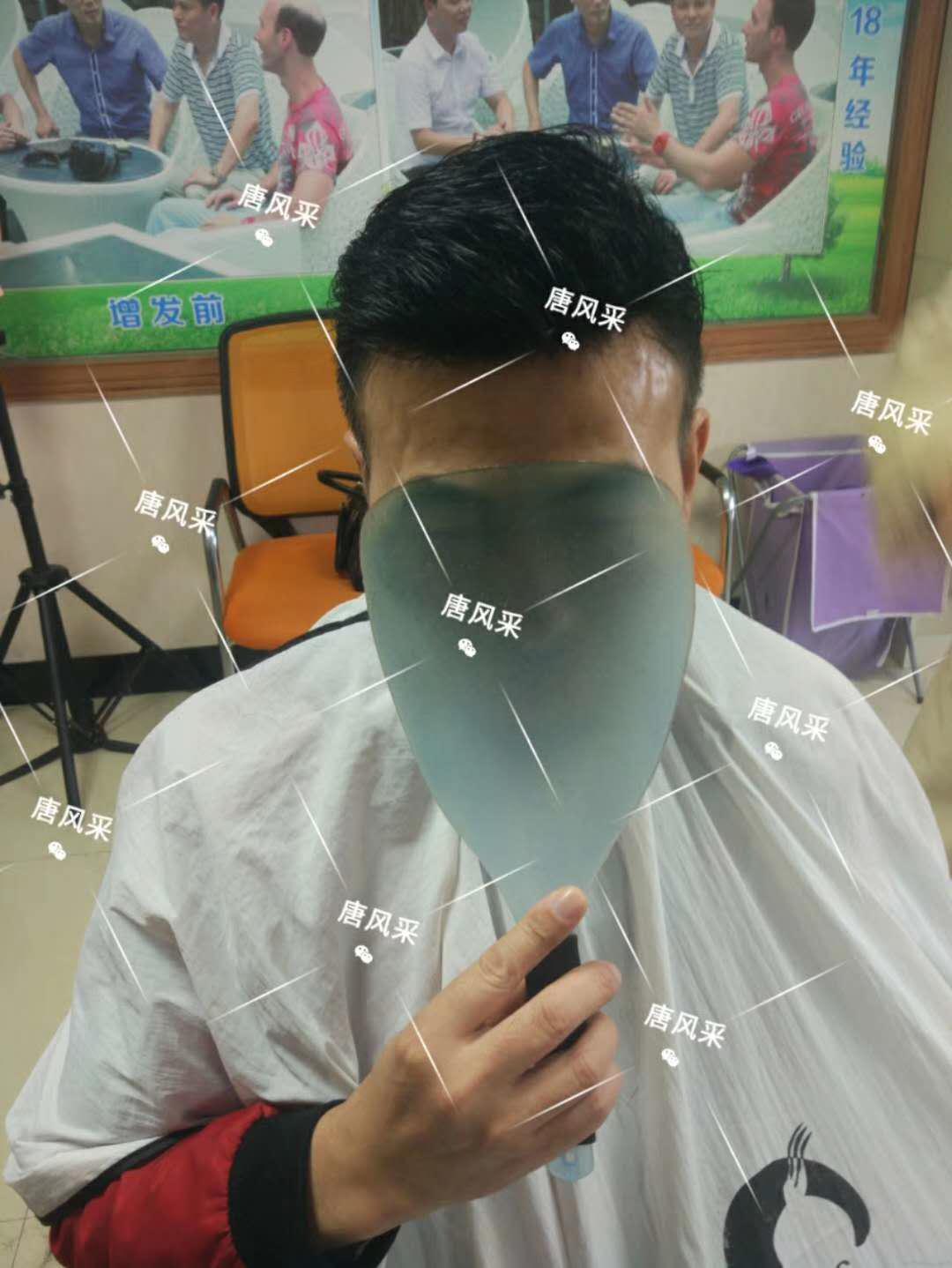 有头发和没头发之间的巨大差距 有头发和没头发之间的巨大差距,看完你就明白了!