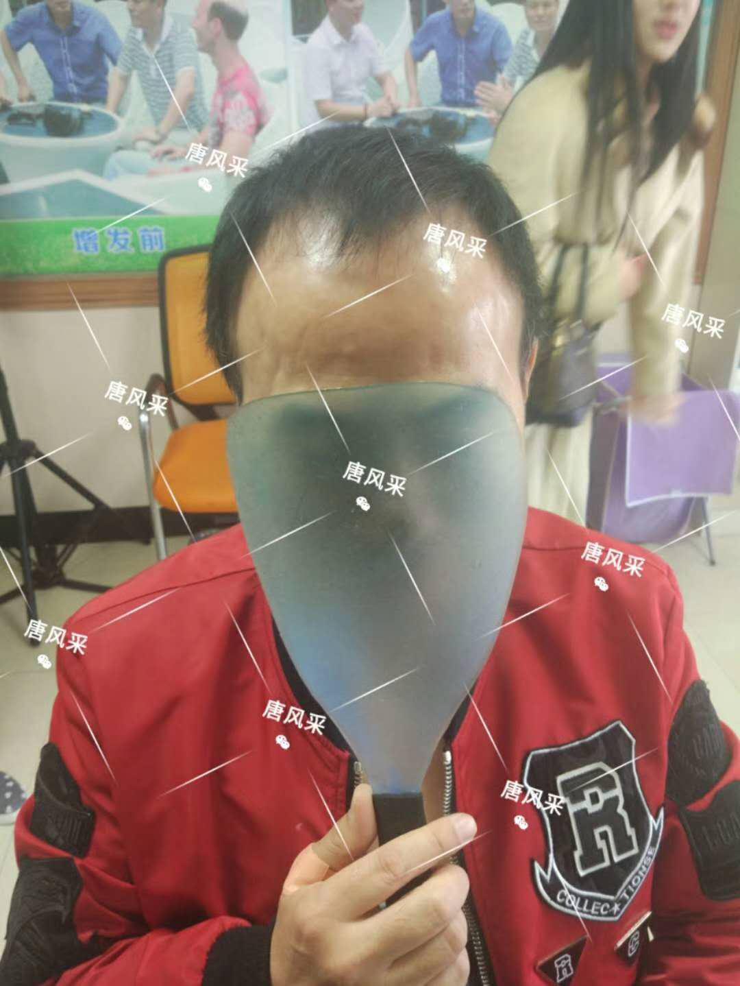 有头发和没头发之间的巨大差距 有头发和没头发之间的巨大差距,看完你就明白了!