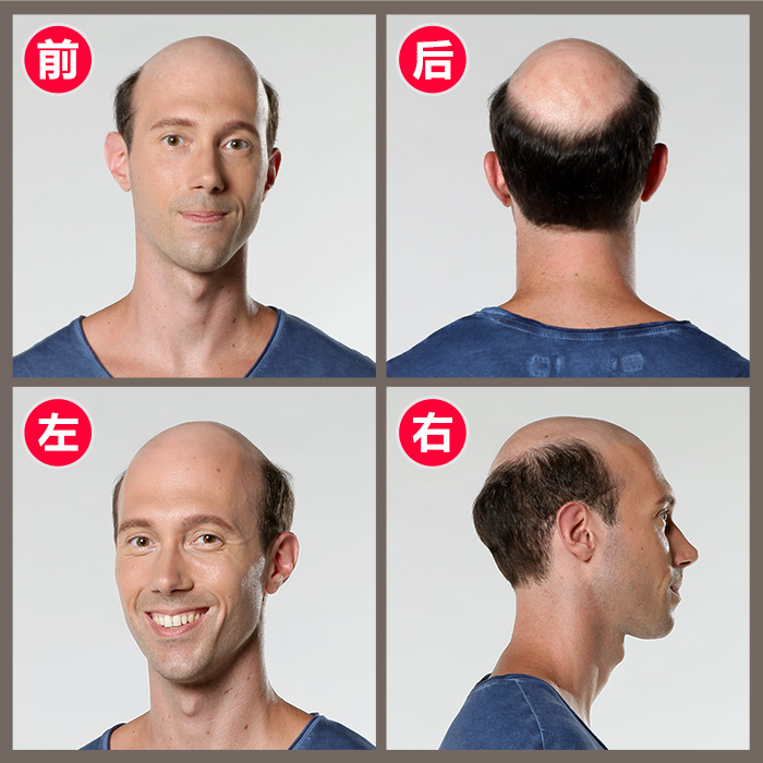 石家庄真人假发如何选？什么牌子值得推荐？