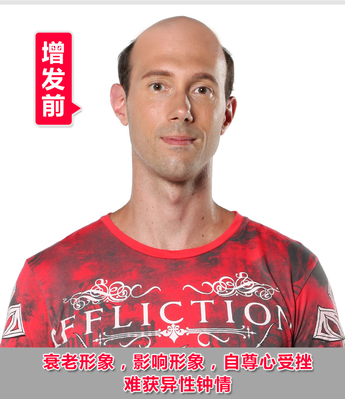 石家庄真人假发如何选？什么牌子值得推荐？