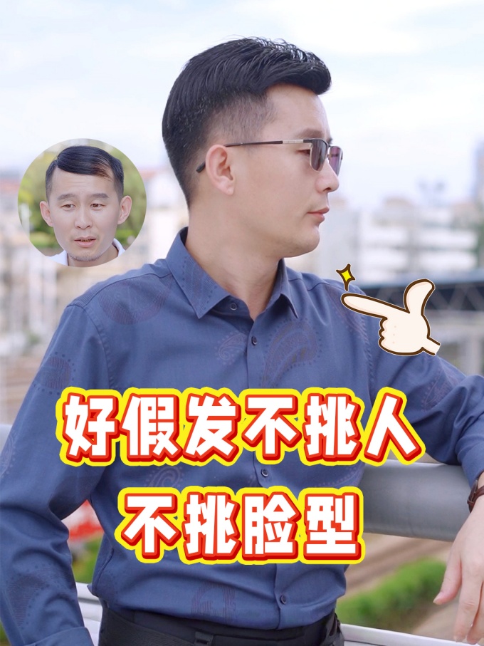 地中海,M发际线,发量问题 \