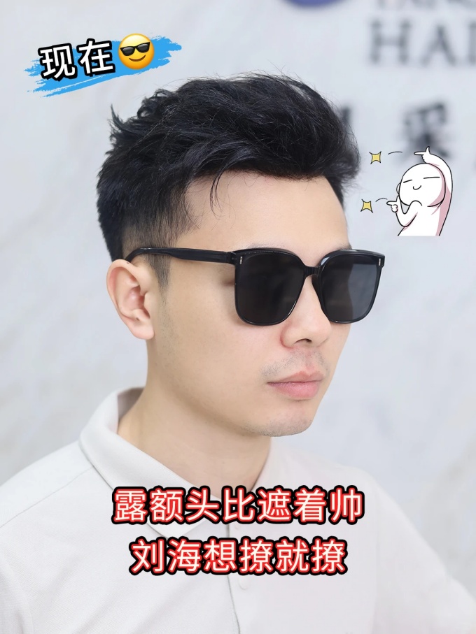 深圳假发,发际线后退 \