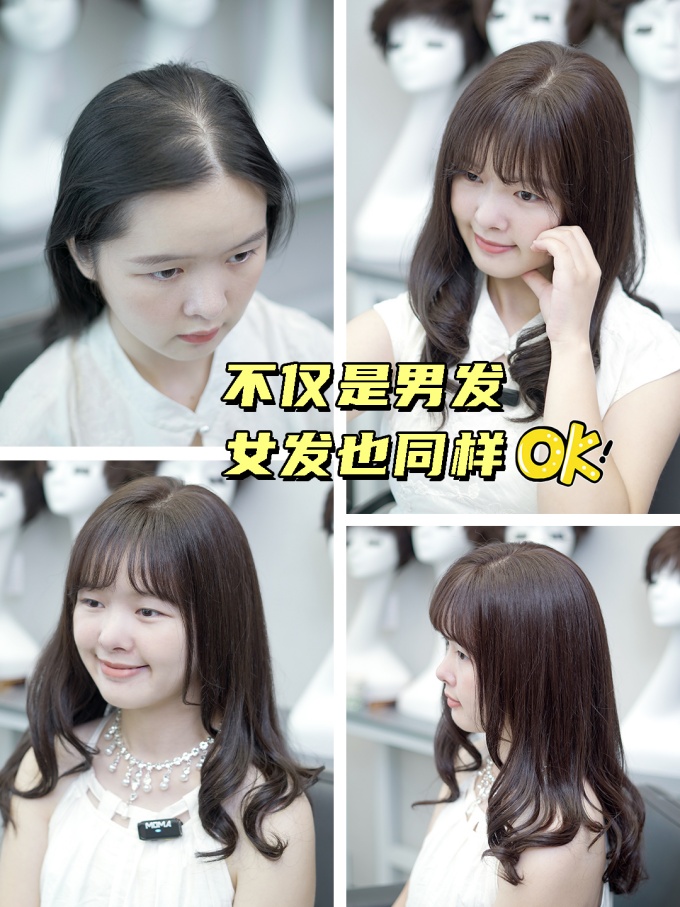 绍兴做假发,适合30~80岁假发 \