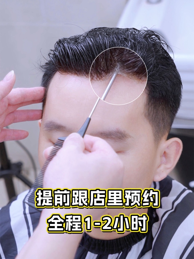 谢顶男生,定制假发 \