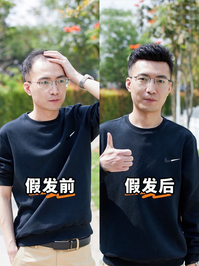 谢顶男生,定制假发 \