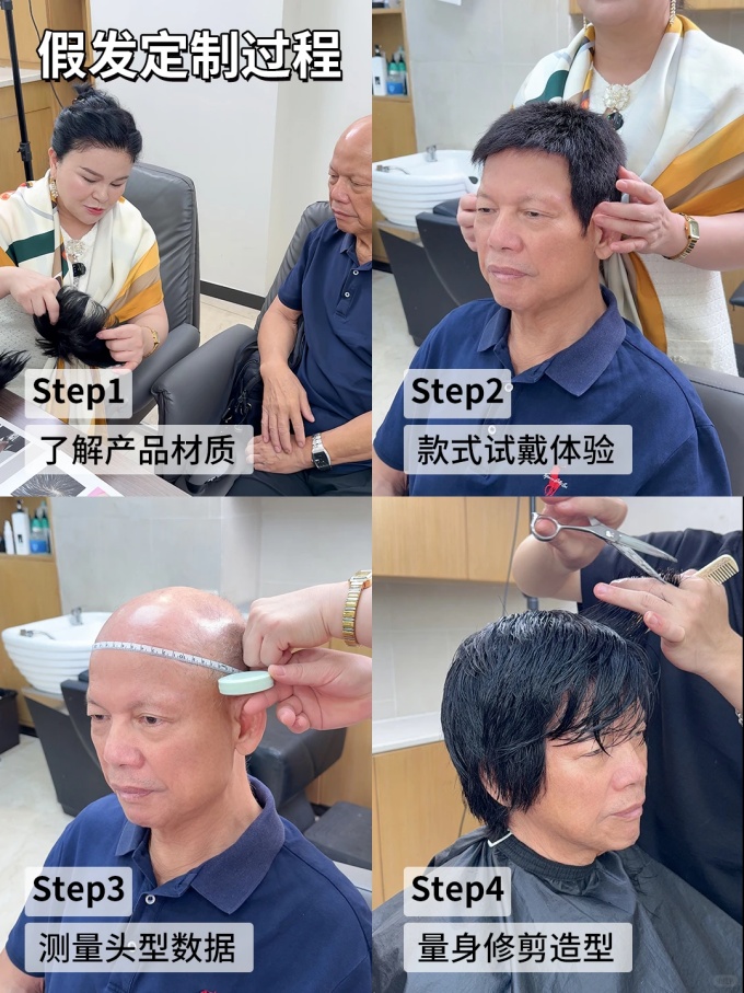 谢顶男生,定制假发 \