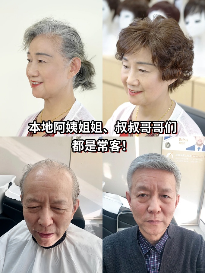 谢顶男生,定制假发 \