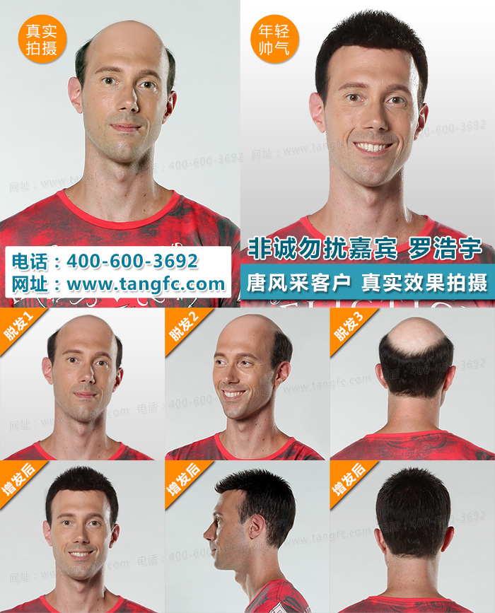 无锡买隐形假发哪家好？有什么特点？