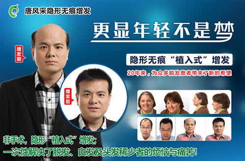 头发脱了秃了怎么办 时光匆匆过,头发脱了秃了怎么办?