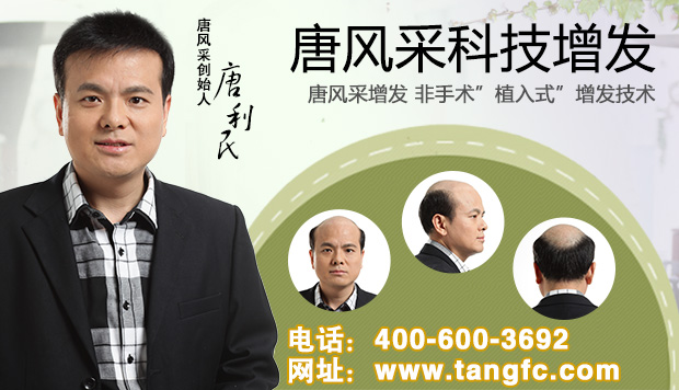 兰州织发哪里好？出现早秃的男神们注意了！