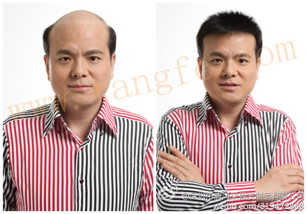 兰州织发哪里好？出现早秃的男神们注意了！