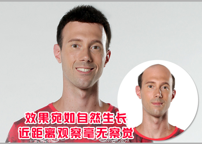 拉萨织发补发需要多少钱？明码标价