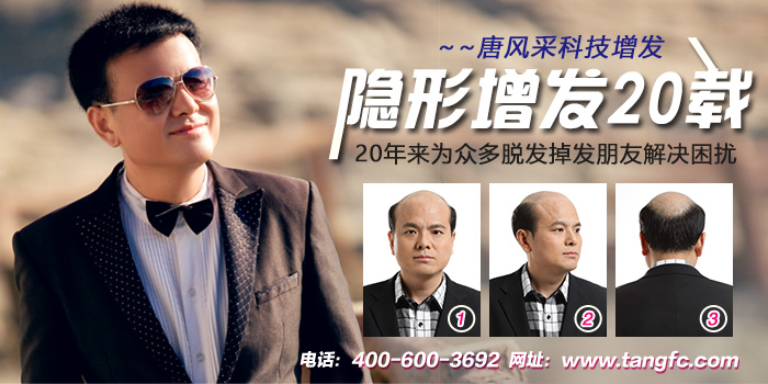 北京织发补发哪家好？怎么收费？