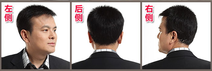 北京织发补发哪家好？怎么收费？