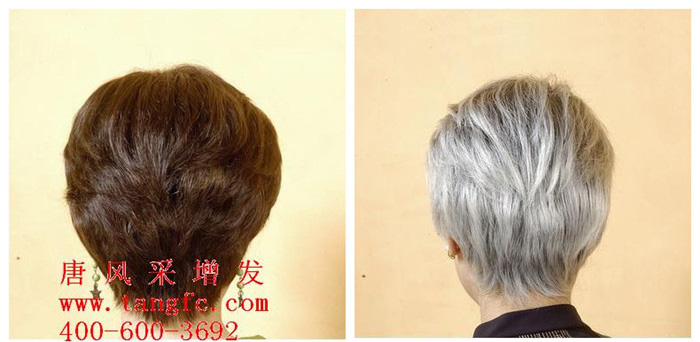 绍兴织发哪里好？唐风采亮法宝解决头发稀少！