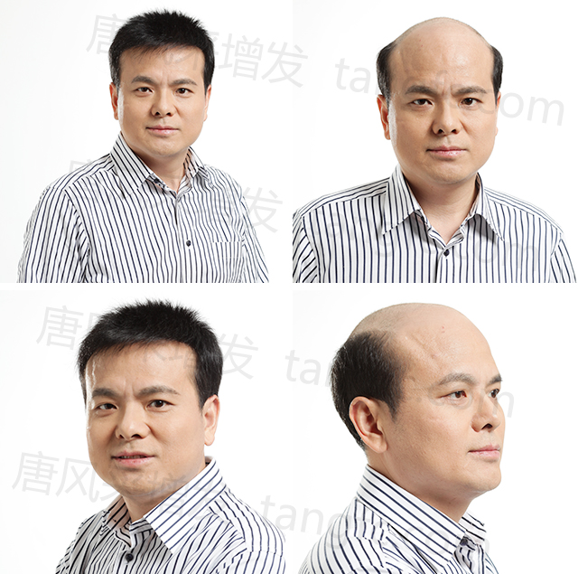 无锡哪有买假发？价位怎样？