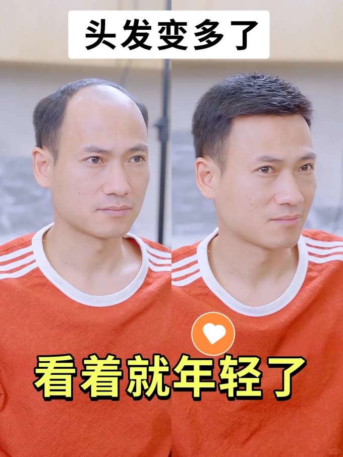 重庆假发,夏天佩戴的假发 \