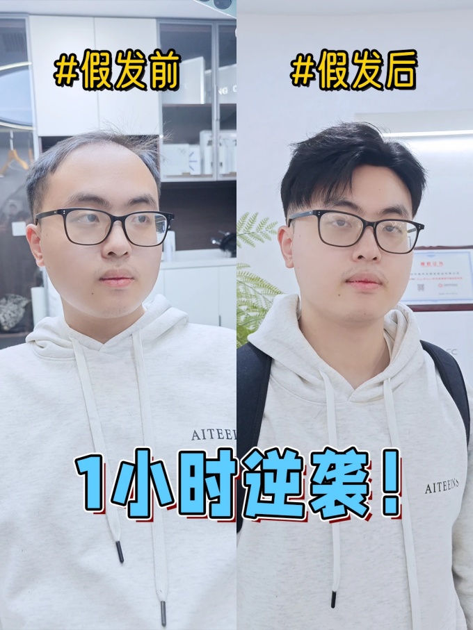 \