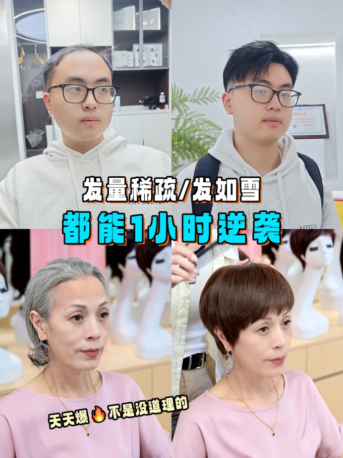 \