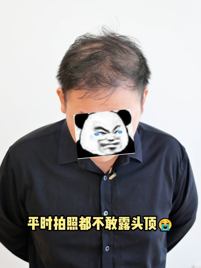 合肥宝藏假发店,男女式假发 \