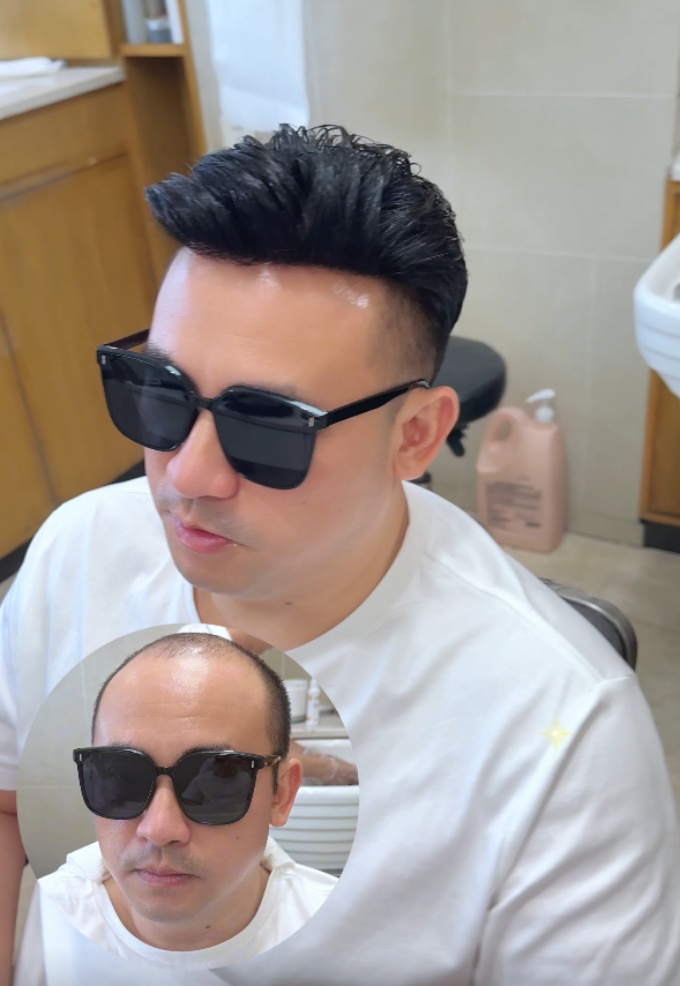 \