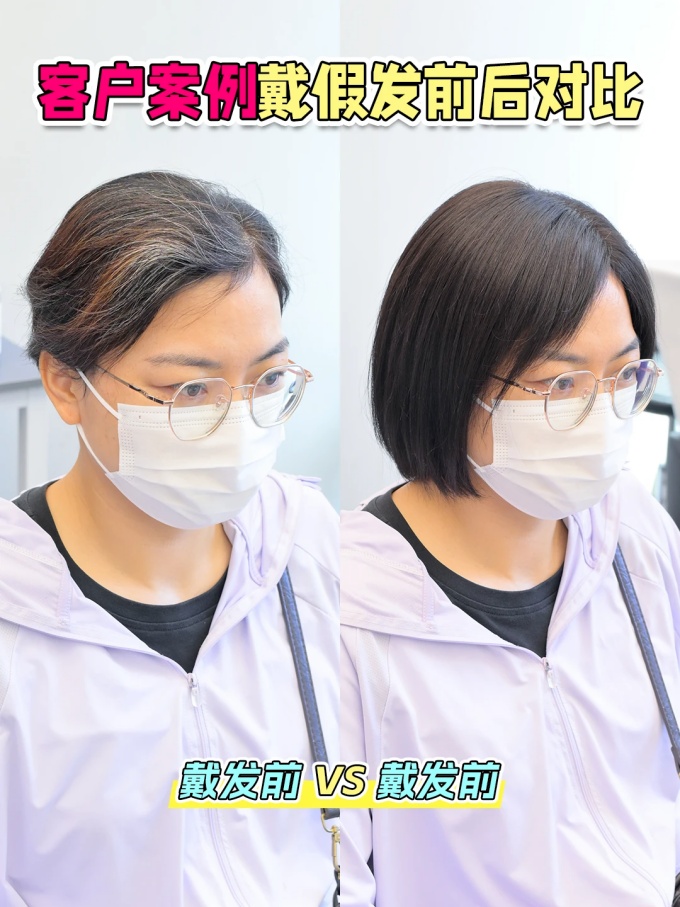 西宁假发定制 \