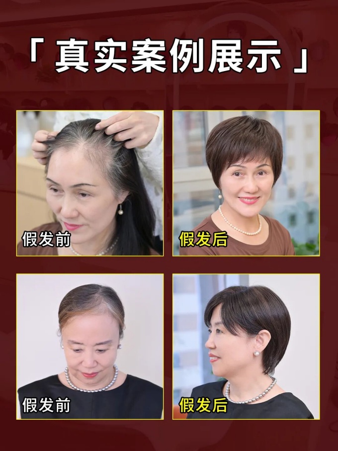 呼和浩特去哪里买假发好 \
